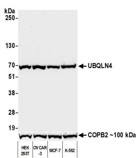 Western blot - Anti-UBQLN4/CIP75/Ubiquilin 4 antibody [BLR145J] - BSA free (AB314066), expandable thumbnail