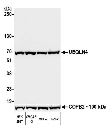 Western blot - Anti-UBQLN4/CIP75/Ubiquilin 4 antibody [BLR145J] - BSA free (AB314066)