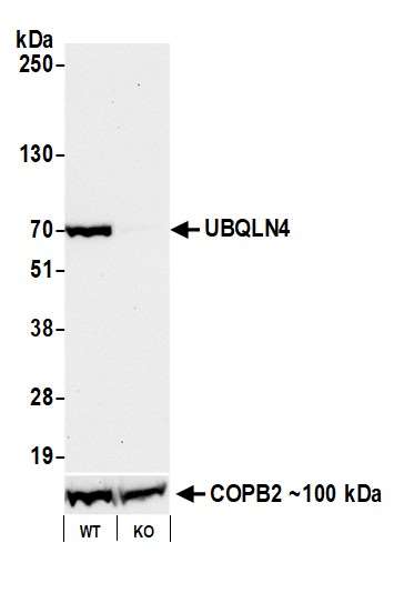 Western blot - Anti-UBQLN4/CIP75/Ubiquilin 4 antibody [BLR145J] - BSA free (AB314066), expandable thumbnail