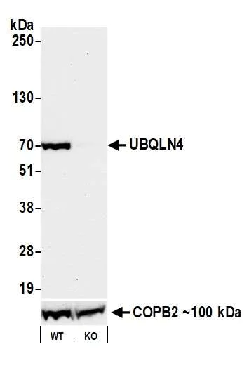 Western blot - Anti-UBQLN4/CIP75/Ubiquilin 4 antibody [BLR145J] - BSA free (AB314066)