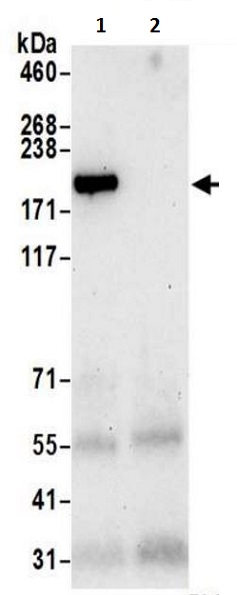 Immunoprecipitation - Anti-UBR2 antibody (AB217069)
