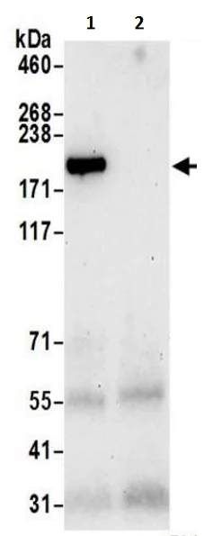 Immunoprecipitation - Anti-UBR2 antibody (AB217069)