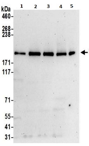 Western blot - Anti-UBR2 antibody (AB217069)