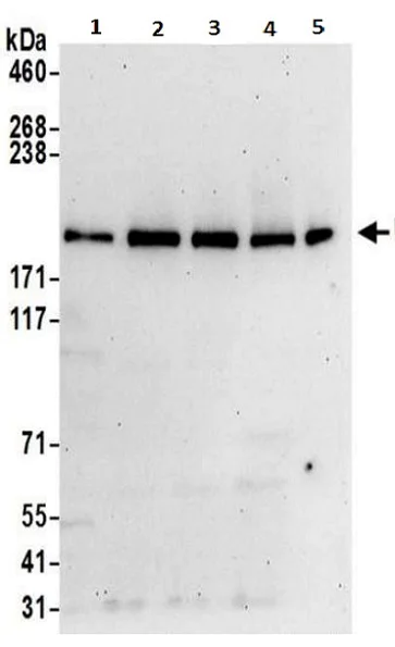 Western blot - Anti-UBR2 antibody (AB217069)