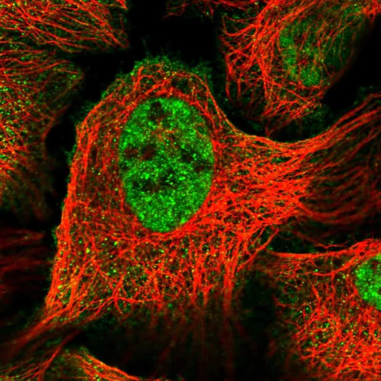 Immunocytochemistry/ Immunofluorescence - Anti-UBR2 antibody (AB254646)