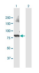 Western blot - Anti-UBR3 antibody (AB169188)