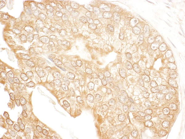 Immunohistochemistry (Formalin/PFA-fixed paraffin-embedded sections) - Anti-UBR4/p600 antibody (AB86738)