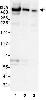 Western blot - Anti-UBR4/p600 antibody (AB86738)