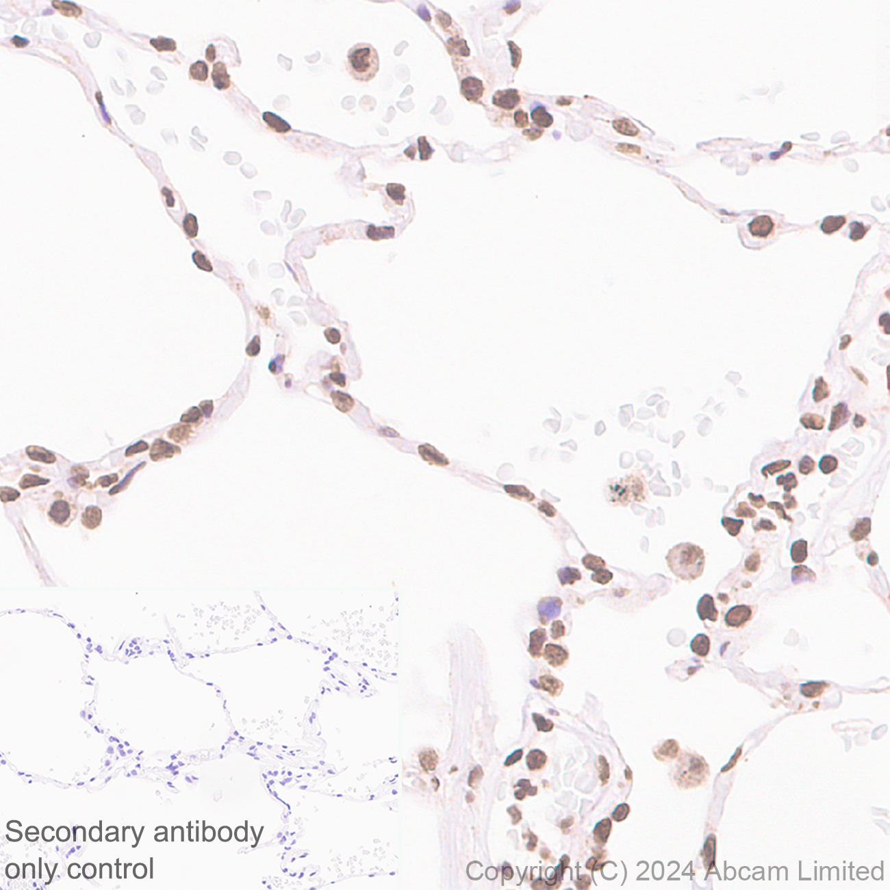 Immunohistochemistry (Formalin/PFA-fixed paraffin-embedded sections) - Anti-UBR4/p600 antibody [EPR28593-48] (AB320819)
