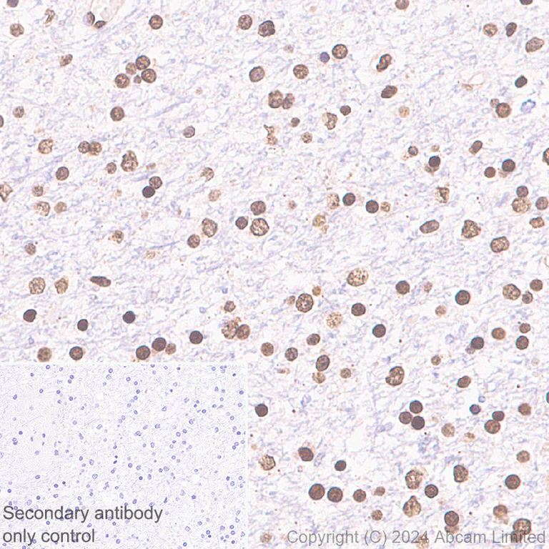 Immunohistochemistry (Formalin/PFA-fixed paraffin-embedded sections) - Anti-UBR4/p600 antibody [EPR28593-48] (AB320819)