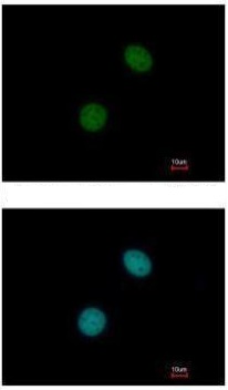 Immunocytochemistry/ Immunofluorescence - Anti-UBR7 antibody (AB228911)