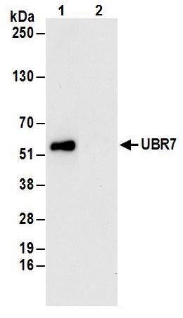 Immunoprecipitation - Anti-UBR7 antibody (AB241371), expandable thumbnail