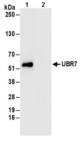 Immunoprecipitation - Anti-UBR7 antibody (AB241371)