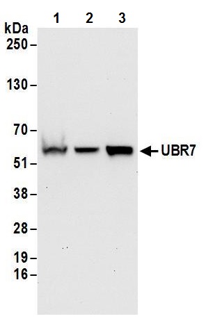 Western blot - Anti-UBR7 antibody (AB241371), expandable thumbnail