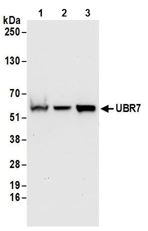 Western blot - Anti-UBR7 antibody (AB241371)