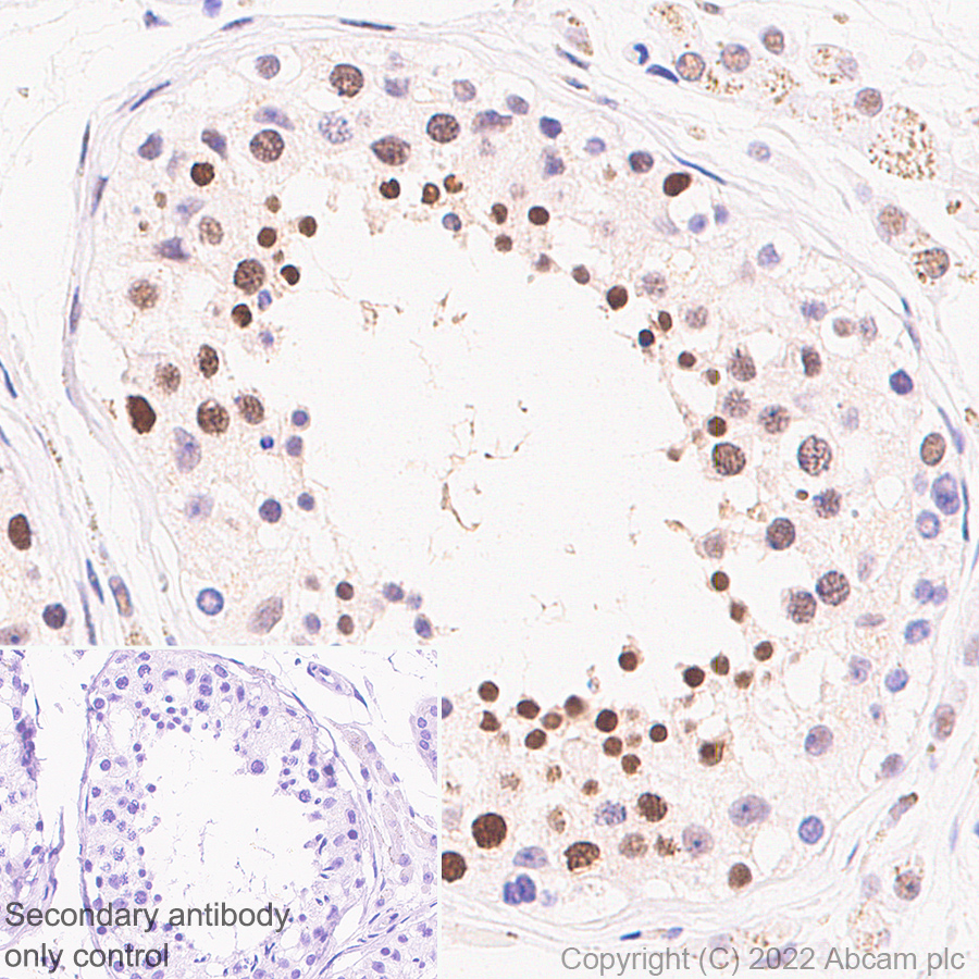 Immunohistochemistry (Formalin/PFA-fixed paraffin-embedded sections) - Anti-UBR7 antibody [EPR26170-67] (AB305239), expandable thumbnail