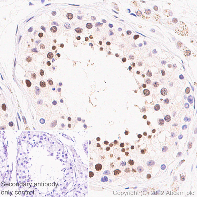 Immunohistochemistry (Formalin/PFA-fixed paraffin-embedded sections) - Anti-UBR7 antibody [EPR26170-67] (AB305239)