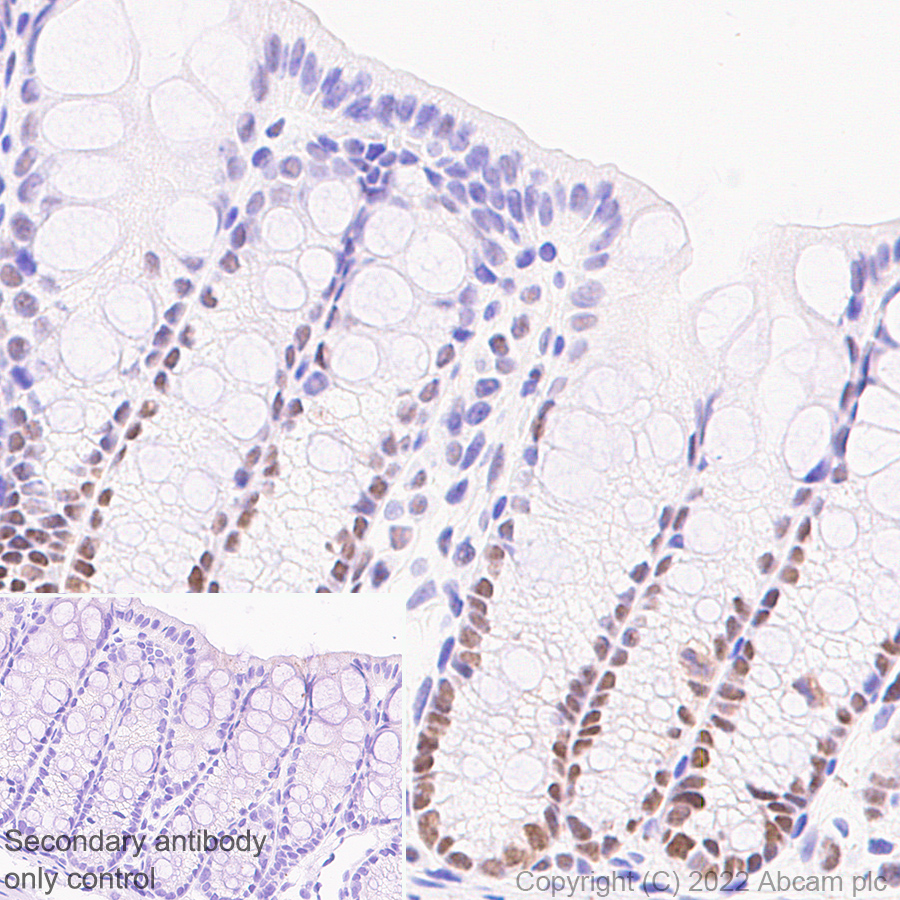 Immunohistochemistry (Formalin/PFA-fixed paraffin-embedded sections) - Anti-UBR7 antibody [EPR26170-67] (AB305239), expandable thumbnail