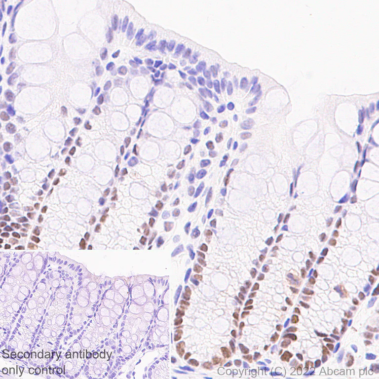 Immunohistochemistry (Formalin/PFA-fixed paraffin-embedded sections) - Anti-UBR7 antibody [EPR26170-67] (AB305239)