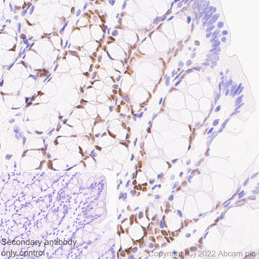 Immunohistochemistry (Formalin/PFA-fixed paraffin-embedded sections) - Anti-UBR7 antibody [EPR26170-67] (AB305239), expandable thumbnail