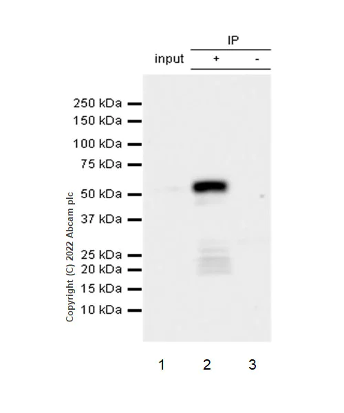 Immunoprecipitation - Anti-UBR7 antibody [EPR26170-67] (AB305239)