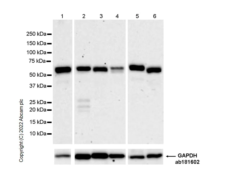Western blot - Anti-UBR7 antibody [EPR26170-67] (AB305239)