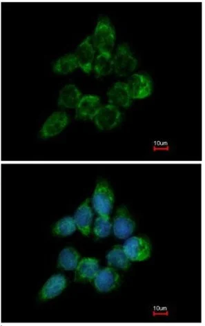 Immunocytochemistry/ Immunofluorescence - Anti-UBXD8 antibody (AB154064)