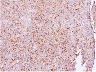 Immunohistochemistry (Formalin/PFA-fixed paraffin-embedded sections) - Anti-UBXD8 antibody (AB154064), expandable thumbnail