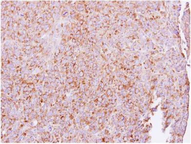 Immunohistochemistry (Formalin/PFA-fixed paraffin-embedded sections) - Anti-UBXD8 antibody (AB154064)