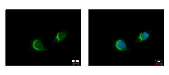 Immunocytochemistry/ Immunofluorescence - Anti-UBXD8 antibody (AB96673)