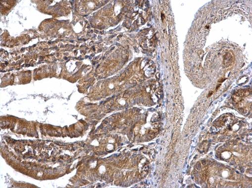 Immunohistochemistry (Formalin/PFA-fixed paraffin-embedded sections) - Anti-UBXD8 antibody (AB96673), expandable thumbnail