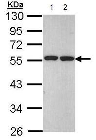 Western blot - Anti-UBXD8 antibody (AB96673), expandable thumbnail