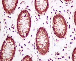 Immunohistochemistry (Formalin/PFA-fixed paraffin-embedded sections) - Anti-UBXN1 antibody [EPR9136] (AB151723)