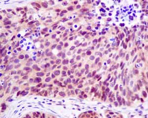 Immunohistochemistry (Formalin/PFA-fixed paraffin-embedded sections) - Anti-UBXN1 antibody [EPR9136] (AB151723)