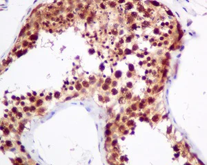 Immunohistochemistry (Formalin/PFA-fixed paraffin-embedded sections) - Anti-UBXN1 antibody [EPR9136] (AB151723)
