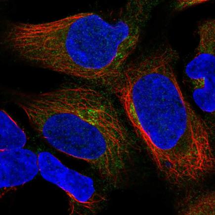 Immunocytochemistry/ Immunofluorescence - Anti-UBXN6/UBXD1 antibody (AB221167), expandable thumbnail
