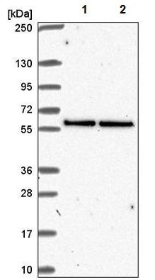 Western blot - Anti-UBXN6/UBXD1 antibody (AB221167), expandable thumbnail