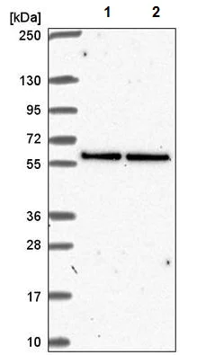Western blot - Anti-UBXN6/UBXD1 antibody (AB221167)