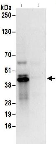 Immunoprecipitation - Anti-UCH37 antibody (AB176377)