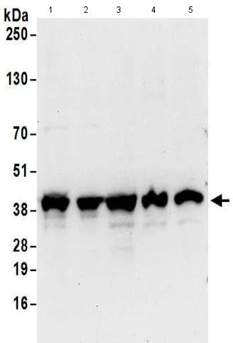 Western blot - Anti-UCH37 antibody (AB176377)