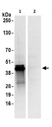Immunoprecipitation - Anti-UCH37 antibody (AB226250)