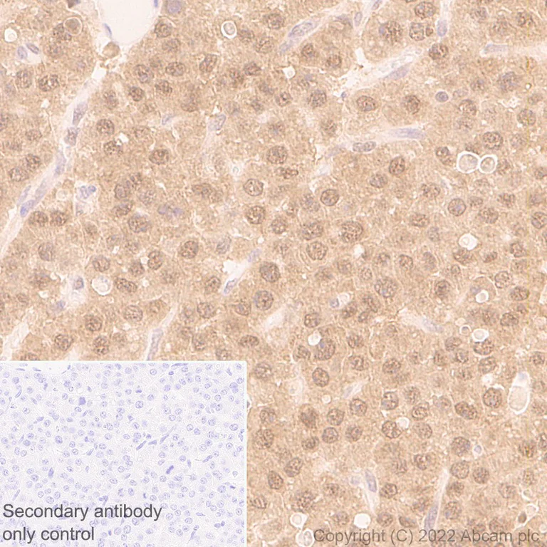 Immunohistochemistry (Formalin/PFA-fixed paraffin-embedded sections) - Anti-UCH37 antibody [EP4897] (AB133508)
