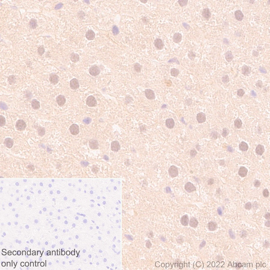 Anti-UCH37 antibody [EP4897]