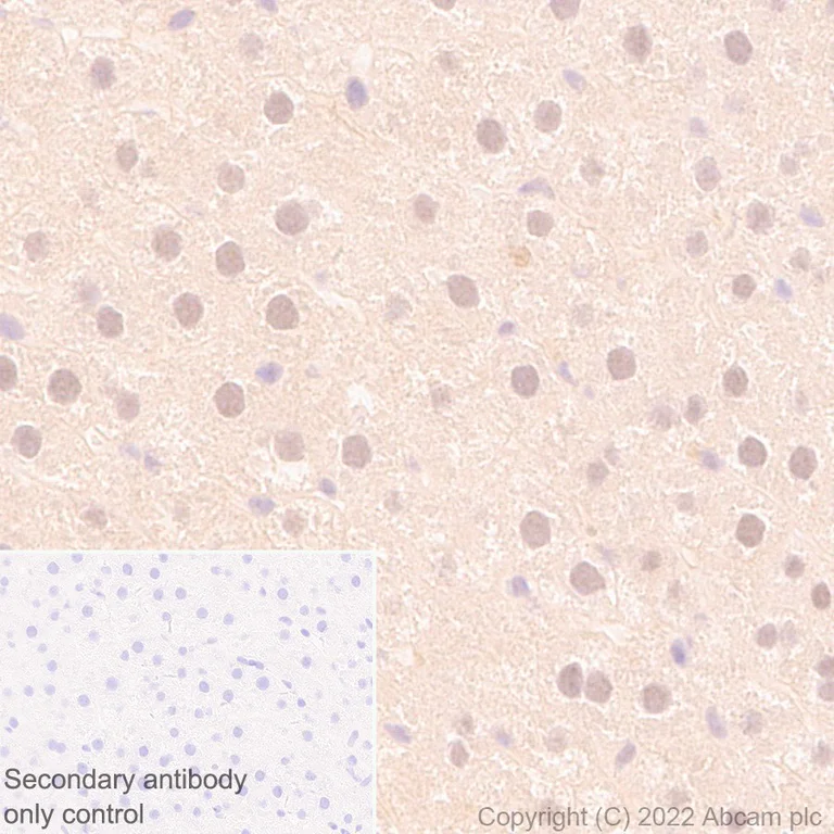 Immunohistochemistry (Formalin/PFA-fixed paraffin-embedded sections) - Anti-UCH37 antibody [EP4897] - BSA and Azide free (AB236002)
