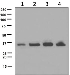 Western blot - Anti-UCH37 antibody [EPR4896] (AB124931)