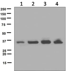 Western blot - Anti-UCH37 antibody [EPR4896] (AB124931)