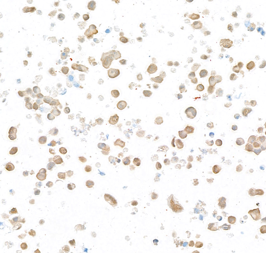 Immunocytochemistry - Anti-UCHL1 antibody [BLR216K] - BSA free (AB314058), expandable thumbnail