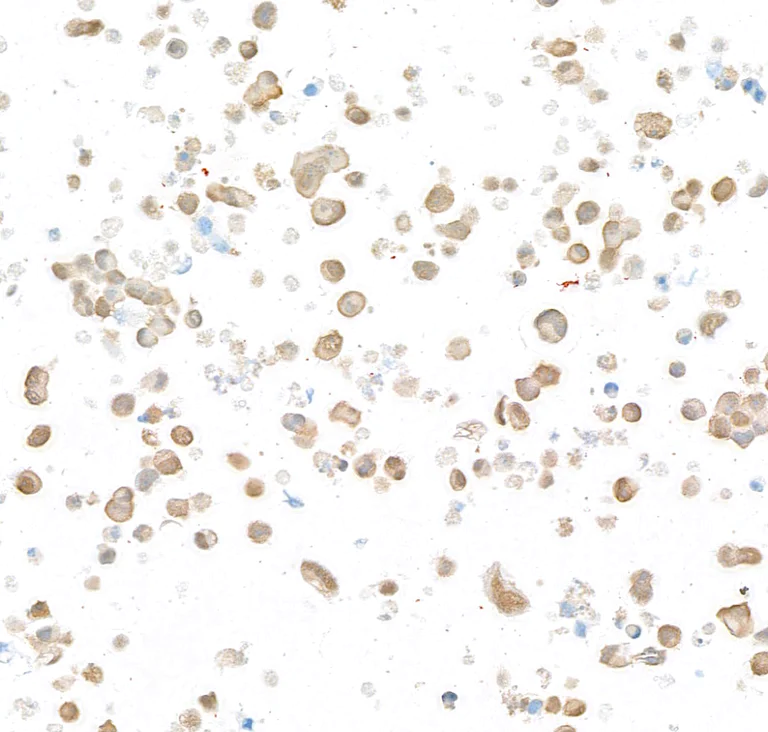 Immunocytochemistry - Anti-UCHL1 antibody [BLR216K] - BSA free (AB314058)