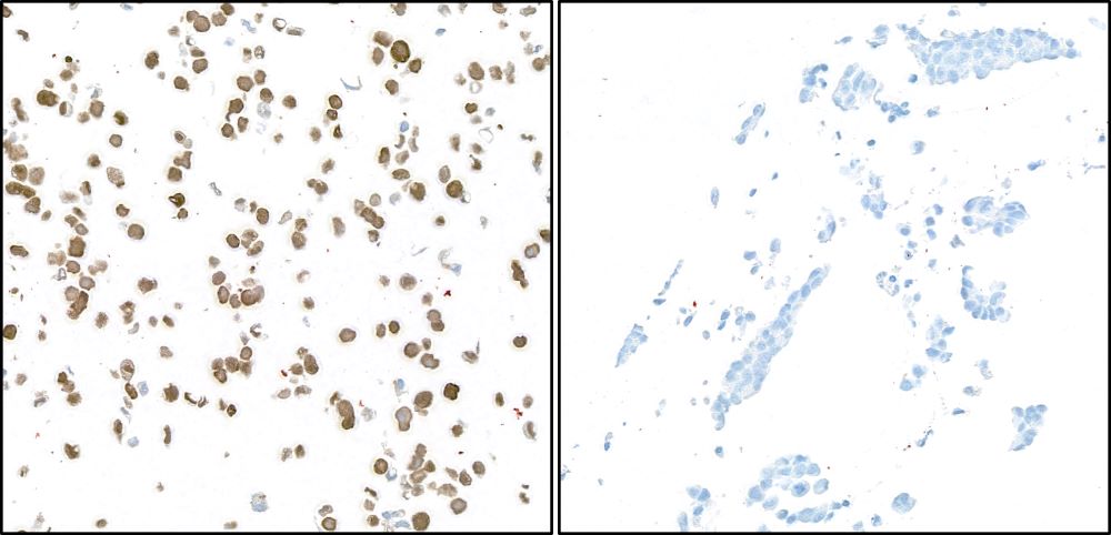 Immunocytochemistry - Anti-UCHL1 antibody [BLR216K] - BSA free (AB314058), expandable thumbnail