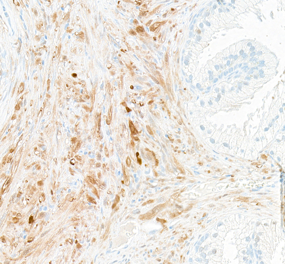 Immunohistochemistry - Anti-UCHL1 antibody [BLR216K] - BSA free (ab314058), expandable thumbnail